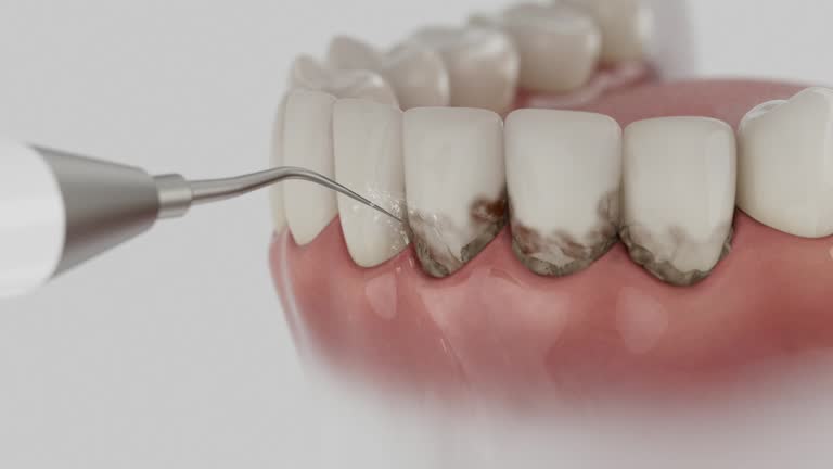 Reliable Dental contractor in Mandan, ND by Smile Center Dentistry